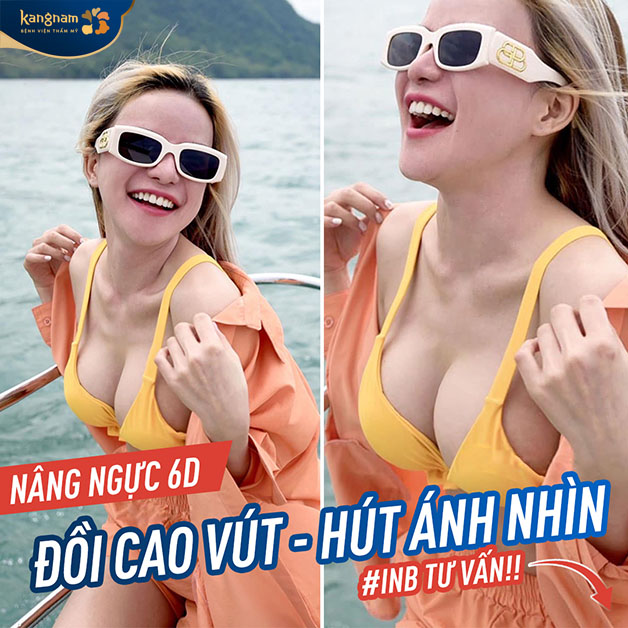 Nâng ngực 6D khi vào form ổn định 