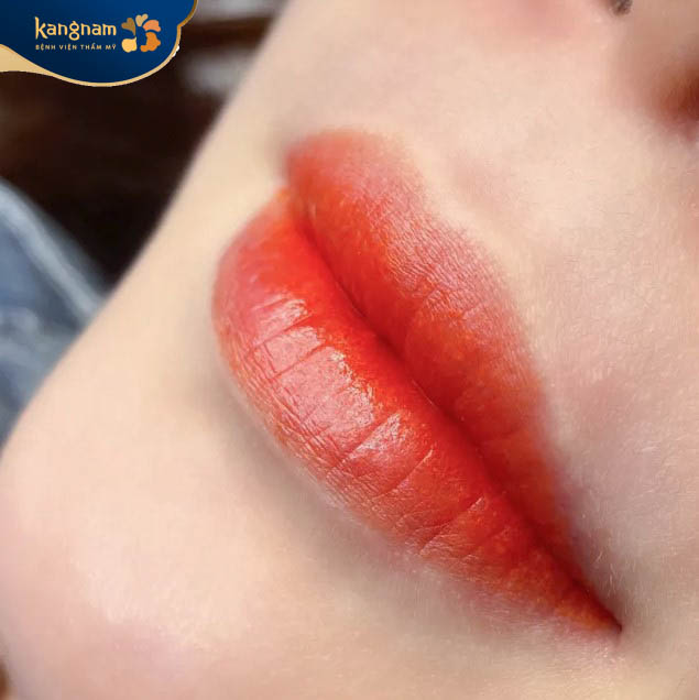 Phun môi khắc phục được các khuyết điểm, môi thâm