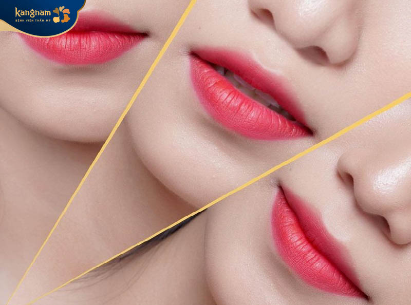 Bạn Hà Anh (28 tuổi, Nam Đàn) sau khi phun môi