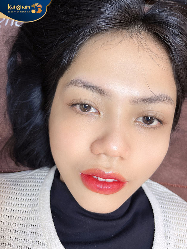 Đôi môi căng mọng