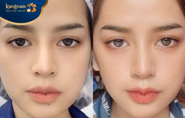 Môi tạo hình đẹp, cân đối 