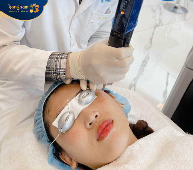 Bác sĩ tiên hành trị tàn nhang bằng laser