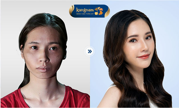 Gương mặt đẹp không góc chết, tự nhiên như trẻ ra vài tuổi