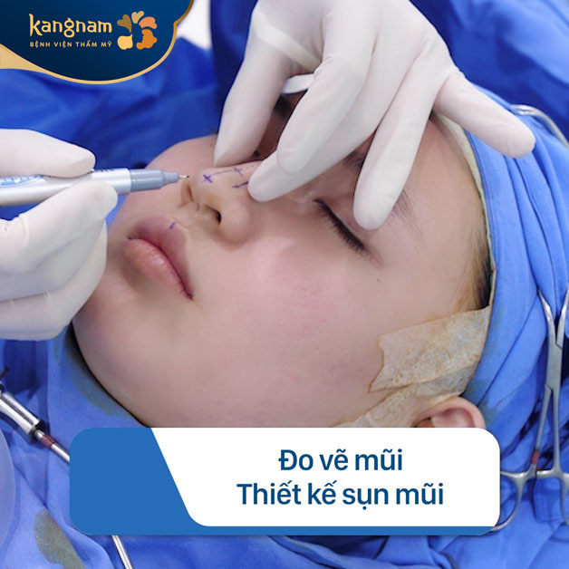 Đo và chọn sụn nâng mũi