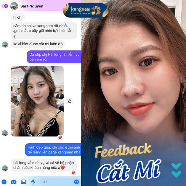 Bạn Sara Nguyễn chia sẻ rất hài lòng sau khi cắt mí tại Kangnam
