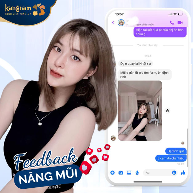 Khách hàng sinh sống tại Nhật Bản cũng tin tưởng về Kangnam nâng mũi, hài lòng với diện mạo mới