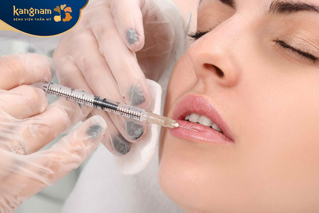 Tiêm môi tây là việc sử dụng chất filler (chất làm đầy) như axit hyaluronic để tạo đôi môi đầy đặn