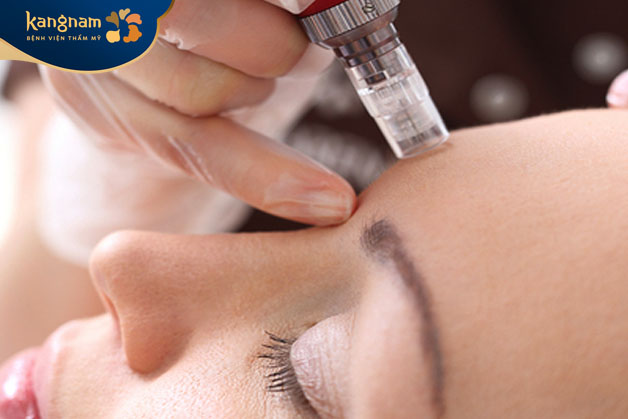 Không đau, không xâm lấn