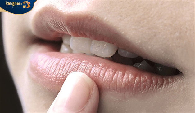 Bờ môi không được chăm sóc, thiếu dưỡng chất dẫn đến bị thâm
