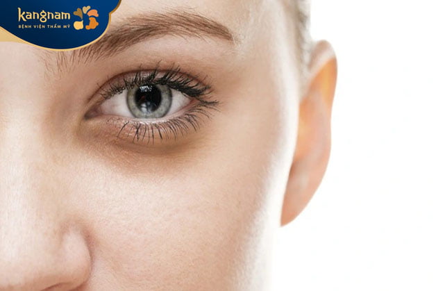 Thiếu nước làm mắt thâm