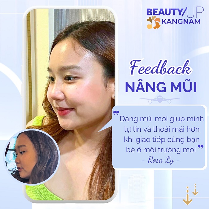 Khách hàng Rosa Ly chia sẻ. nâng mũi giúp bạn tư tin và thoải mái