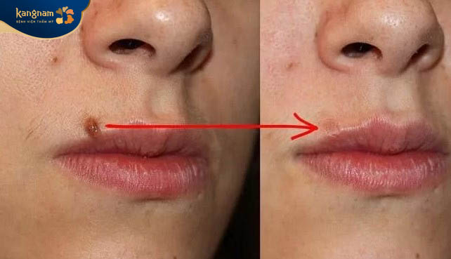 Làn da sáng mịn, đều màu