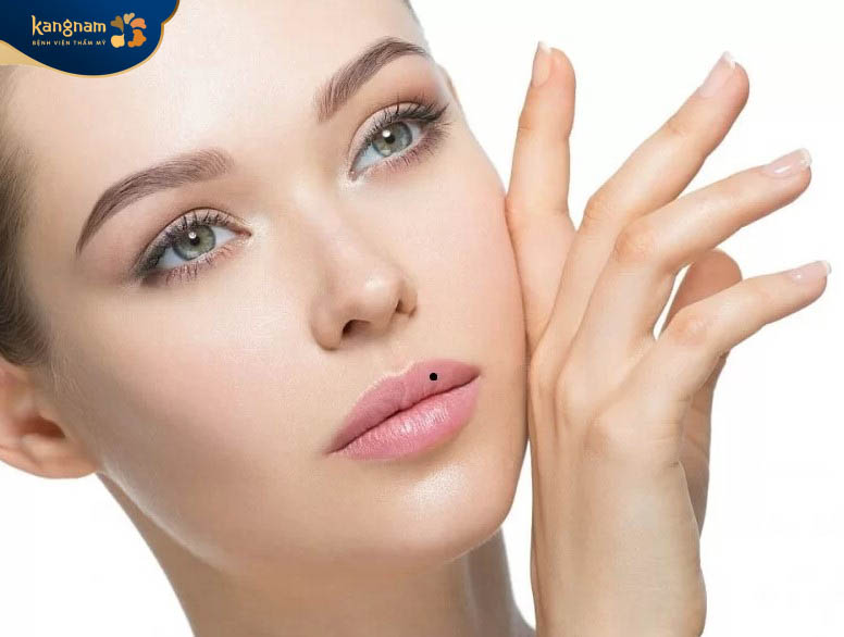 Nốt ruồi mọc ở môi trên