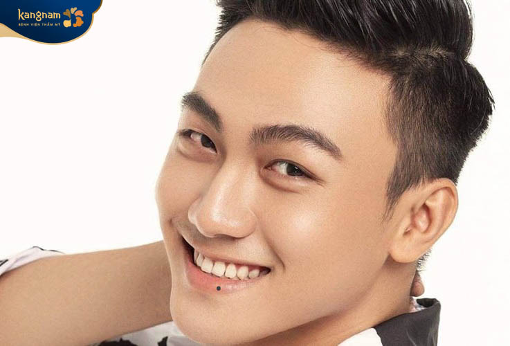 Nốt ruồi ở môi dưới là những người thân thiện, dễ mến