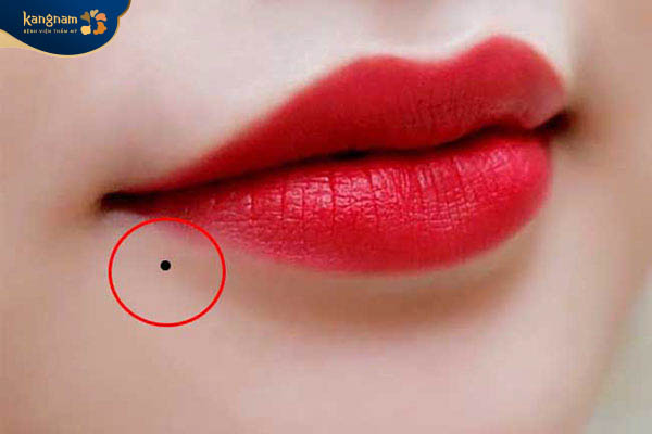 Nốt ruồi mọc tại khóe miệng bên trái