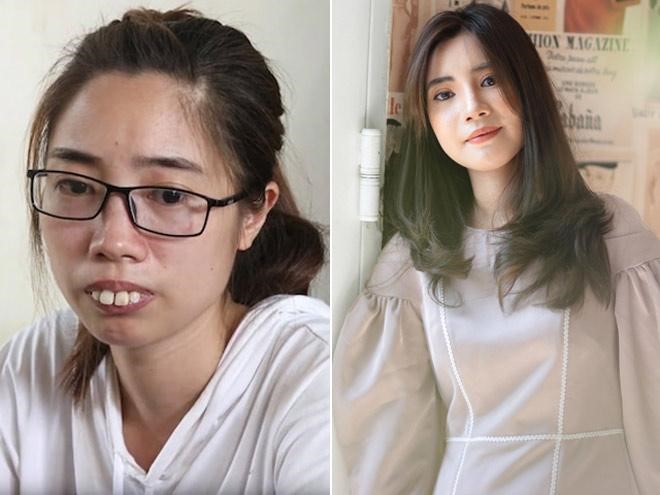 Nguyễn Thị Huê gây sốt cõi mạng sau khi tham gia Hành trình lột xác cùng Kangnam