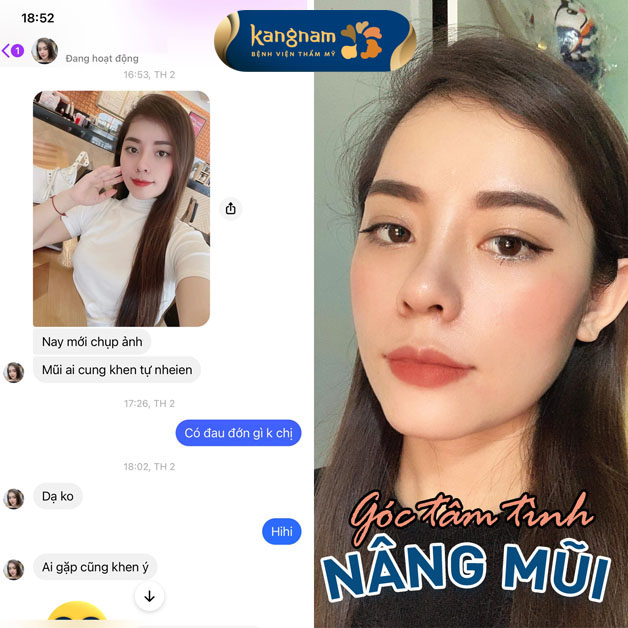 Mũi đẹp tự nhiên, không đơ cứng