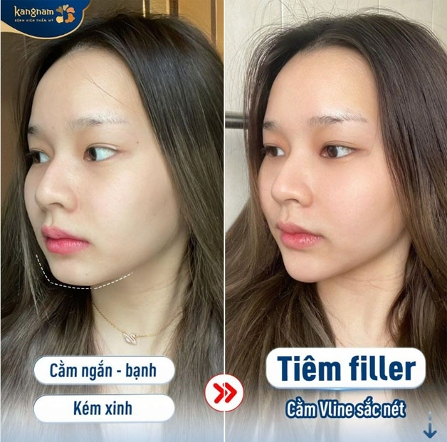 Tự tin hơn với góc nghiêng thần thánh