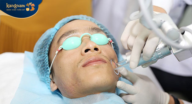 điều trị sẹo rỗ bằng công nghệ laser fractional co2