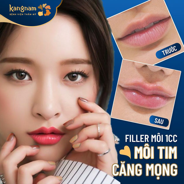 Filler môi tim đầy đặn, xinh xắn
