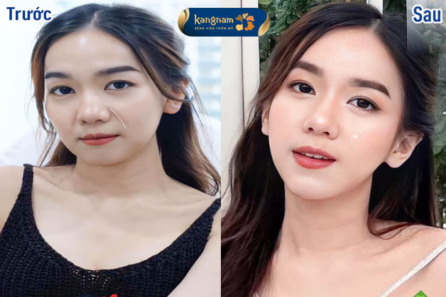 Chị khách cảm thấy hạnh phúc hơn với diện mạo mới