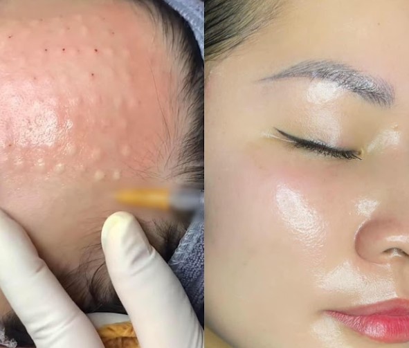 Cấp ẩm cho làn da