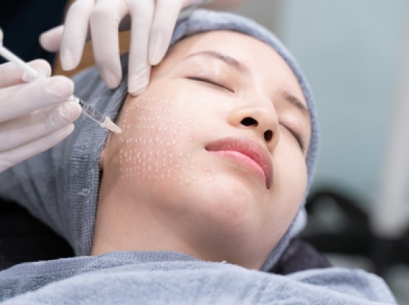 Tiêm meso giúp da căng bóng, mịn màng