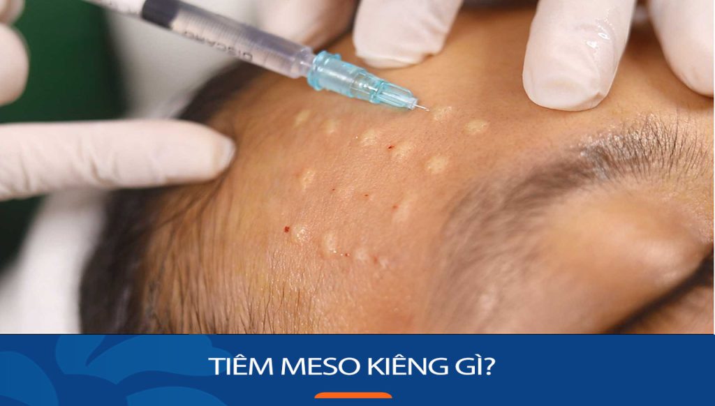 Tiêm meso ăn gì, kiêng gì để có hiệu quả tốt nhất?