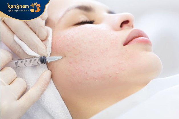 để đạt được kết quả đẹp thường từ 1 đến 2 lần