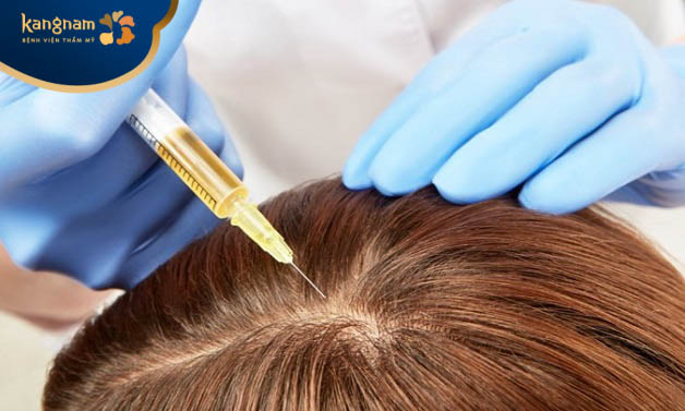 Tại sao tiêm meso kích thích mọc tóc?