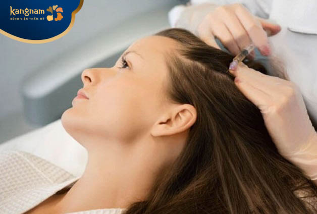 Thực hiện tiêm meso kích thích mọc tóc