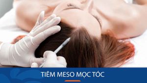 Tiêm meso mọc tóc: Giải pháp cho mái tóc dày dặn và bồng bềnh