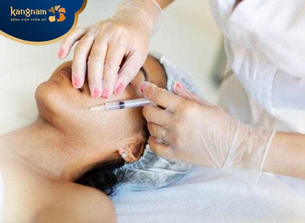 Tiêm meso điều trị sẹo rỗ là gì?