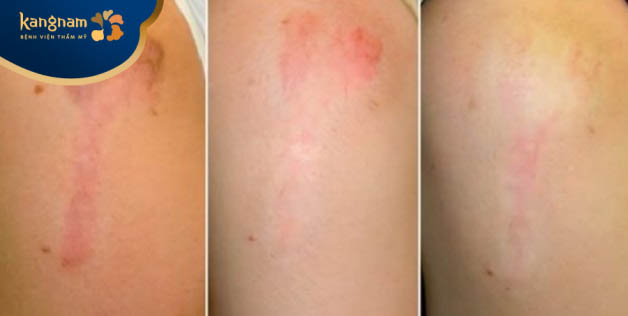 Bạn Thu Trang feedback