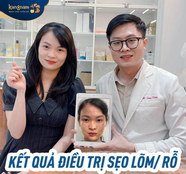 Khách hàng cảm thấy hài lòng sau khi trị sẹo tại Kangnam