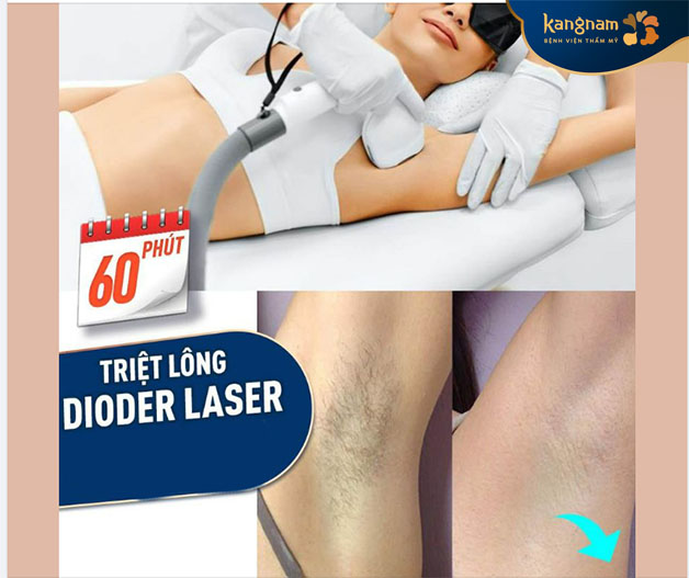 Chỉ khoảng 60 phút dọn sạch lông trả lại làn da mịn màng