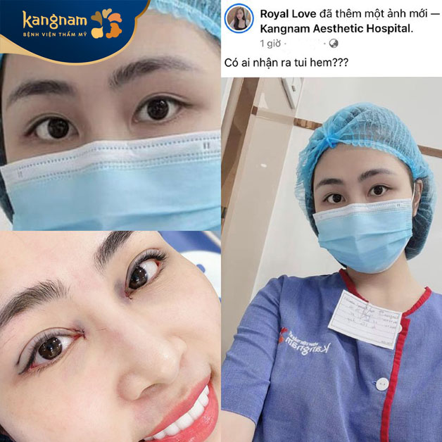 Khách hàng nhấn mí tại Kangnam xinh lung linh