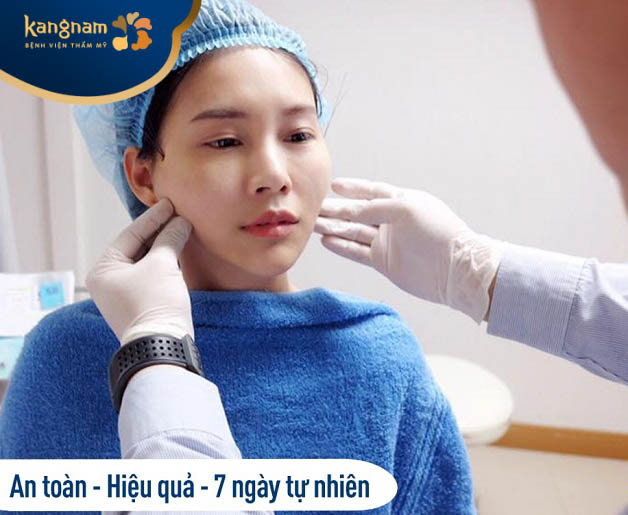 Căng chỉ xóa nhăn rãnh cười là phương pháp làm đẹp an toàn