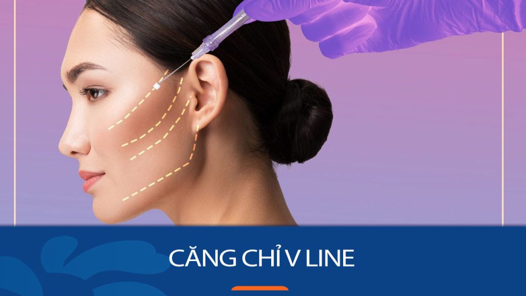 Căng chỉ V line có thực sự hiệu quả? Giải pháp thẩm mỹ hot nhất hiện nay
