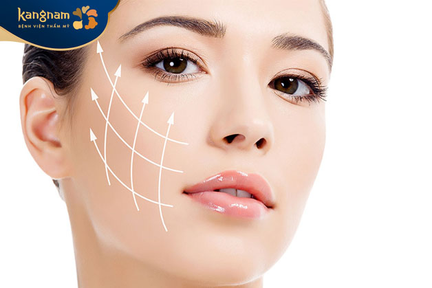 Căng chỉ tạo mặt V line là phương pháp làm đẹp không phẫu thuật