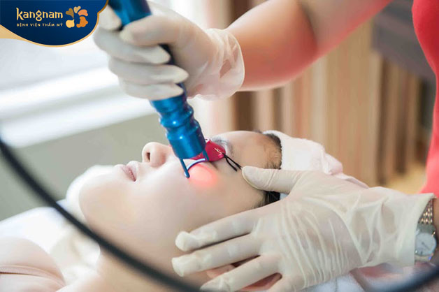 Laser giúp kích thích tăng sinh collagen giúp da đàn hồi tốt hơn 