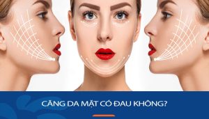 Căng da mặt có đau không? Giải đáp thắc mắc các cách căng da mặt phổ biến