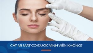 Cắt mí mắt có được vĩnh viễn không? Thời gian duy trì và yếu tố ảnh hưởng
