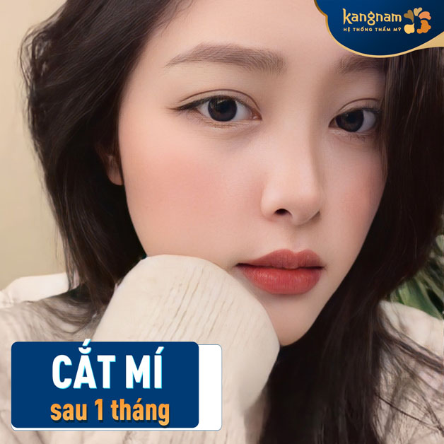 Sau khi mí mắt đã lành, bạn vẫn nên chú ý chăm sóc để kết quả dài lâu