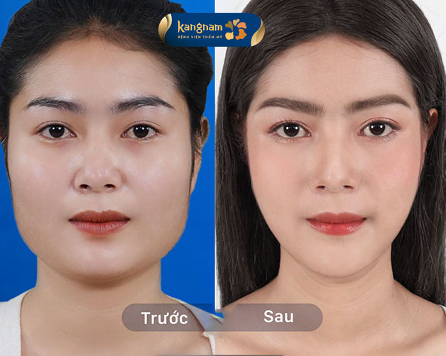 Kết quả sau khi thực hiện đúng như mô phỏng