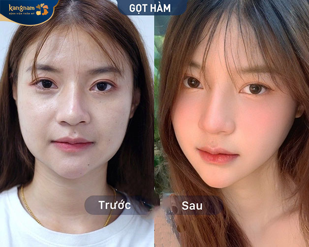 Gương mặt chuẩn Vline đẹp tự nhiên