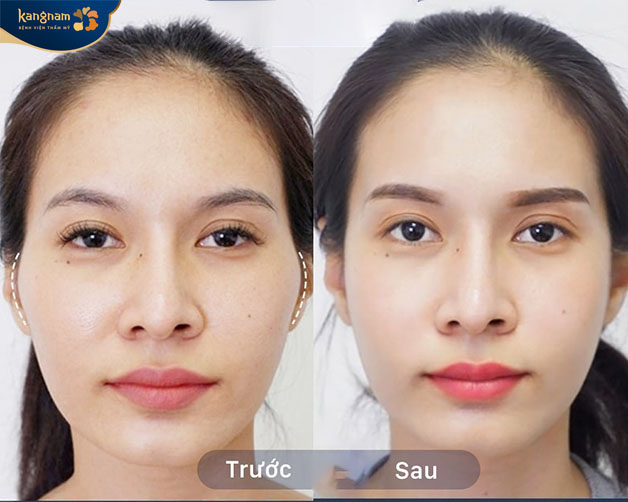 Sự thay đổi của khách hàng có thể nhìn thấy rõ ràng