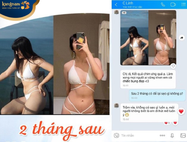 Chị Linh gửi ảnh mặc bikini khoe dáng sau hút mỡ 2 tháng