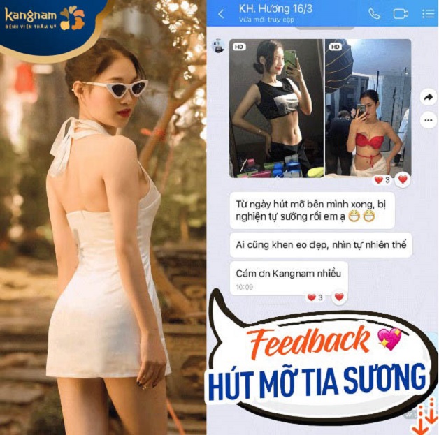 Khách hàng Hương feedback sau hút mỡ tia sương 6D tại Kangnam Cần Thơ