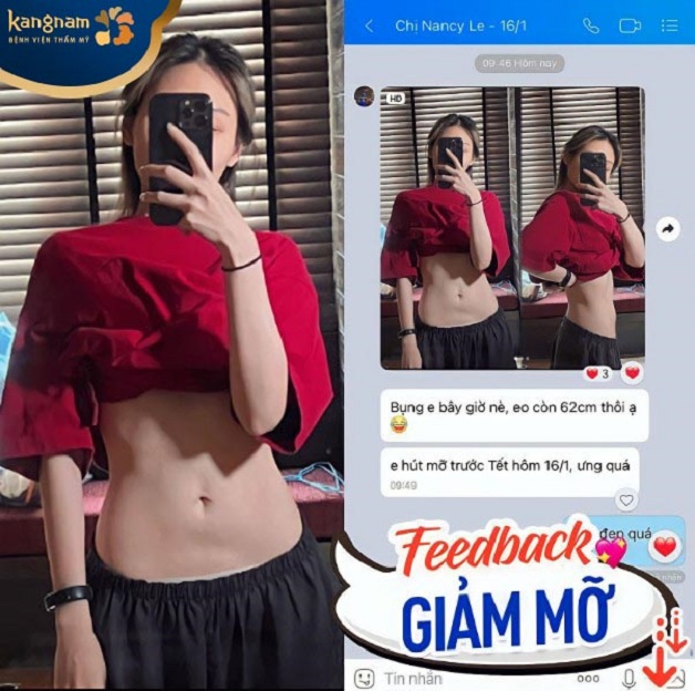 Chị Nancy Le gửi feedback kèm theo lời nhắn thể hiện sự hài lòng sau hút mỡ